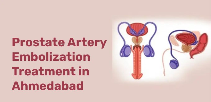 breast lump treatment in Ahmedabad