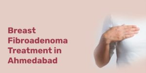 breast lump treatment in Ahmedabad